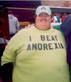 Fat Guy Anorexia